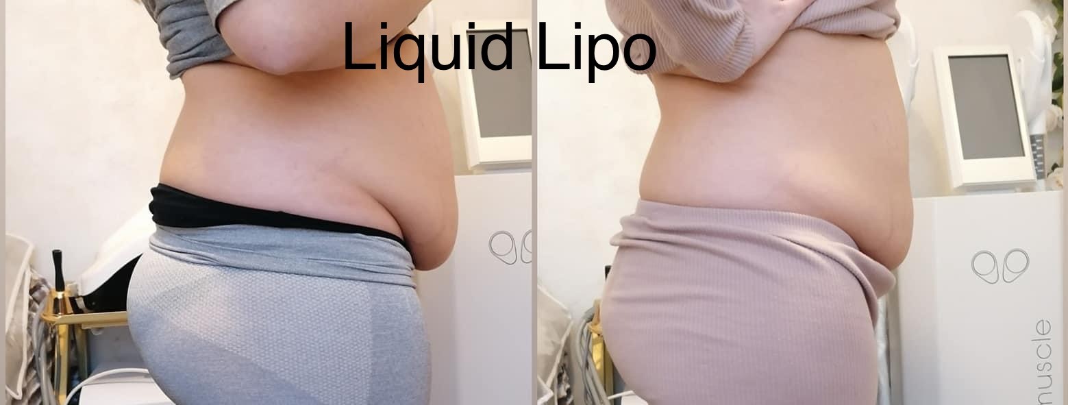 liquid_lipo_1