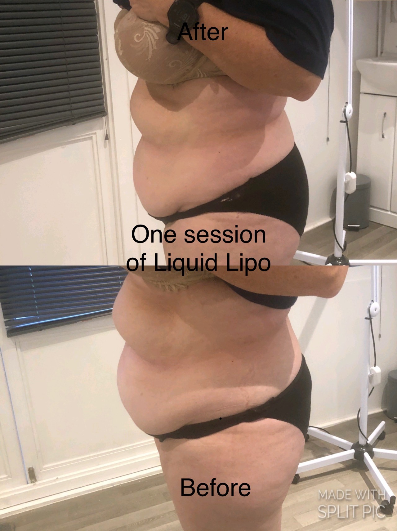 liquid_lipo_3